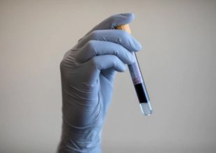 Plasma de pacientes recuperados: lo que sabemos y lo que ignoramos