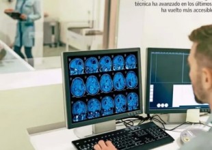 escleriosis