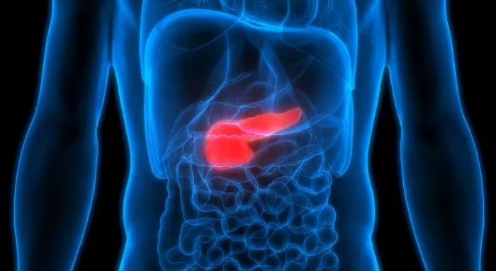 cancer_pancreas2